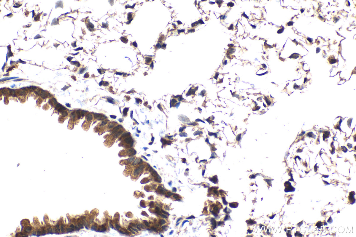 Immunohistochemical analysis of paraffin-embedded rat lung tissue slide using KHC2087 (BCL2L11/BIM IHC Kit).