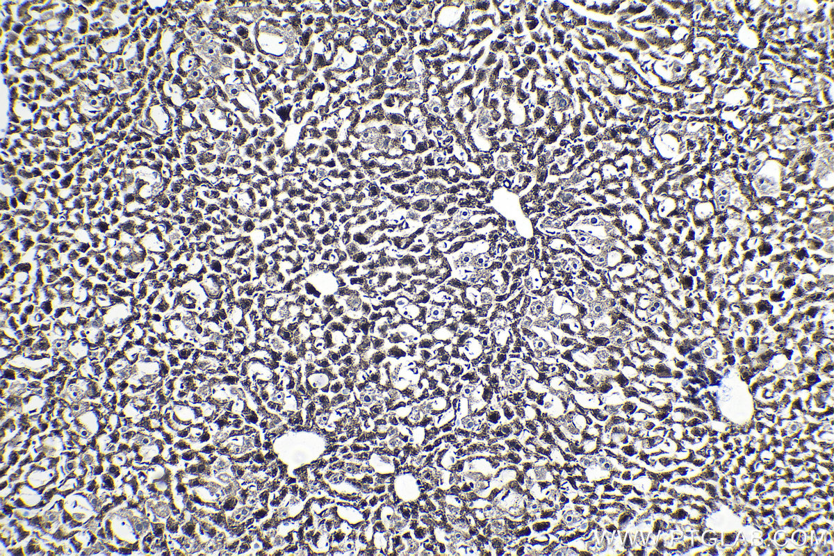 Immunohistochemical analysis of paraffin-embedded mouse liver tissue slide using KHC1413 (BCL2L2 IHC Kit).