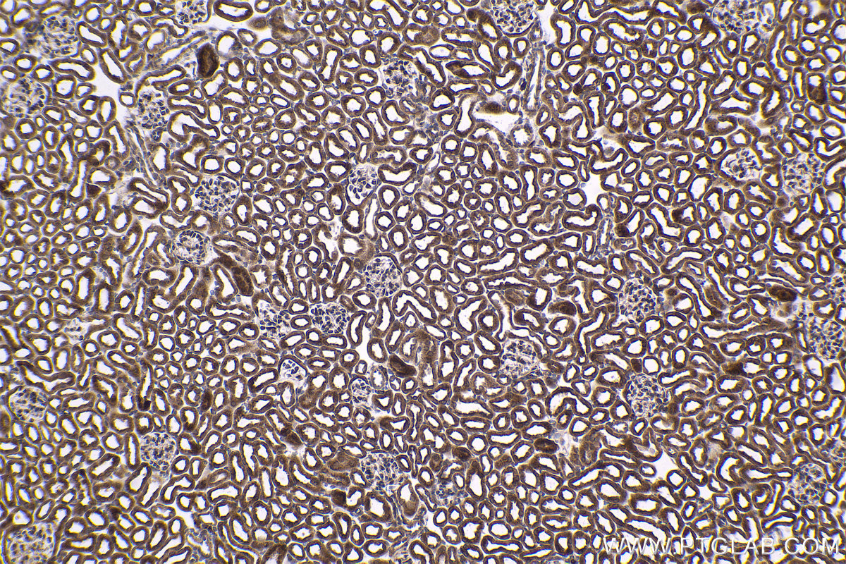 Immunohistochemical analysis of paraffin-embedded mouse kidney tissue slide using KHC1413 (BCL2L2 IHC Kit).
