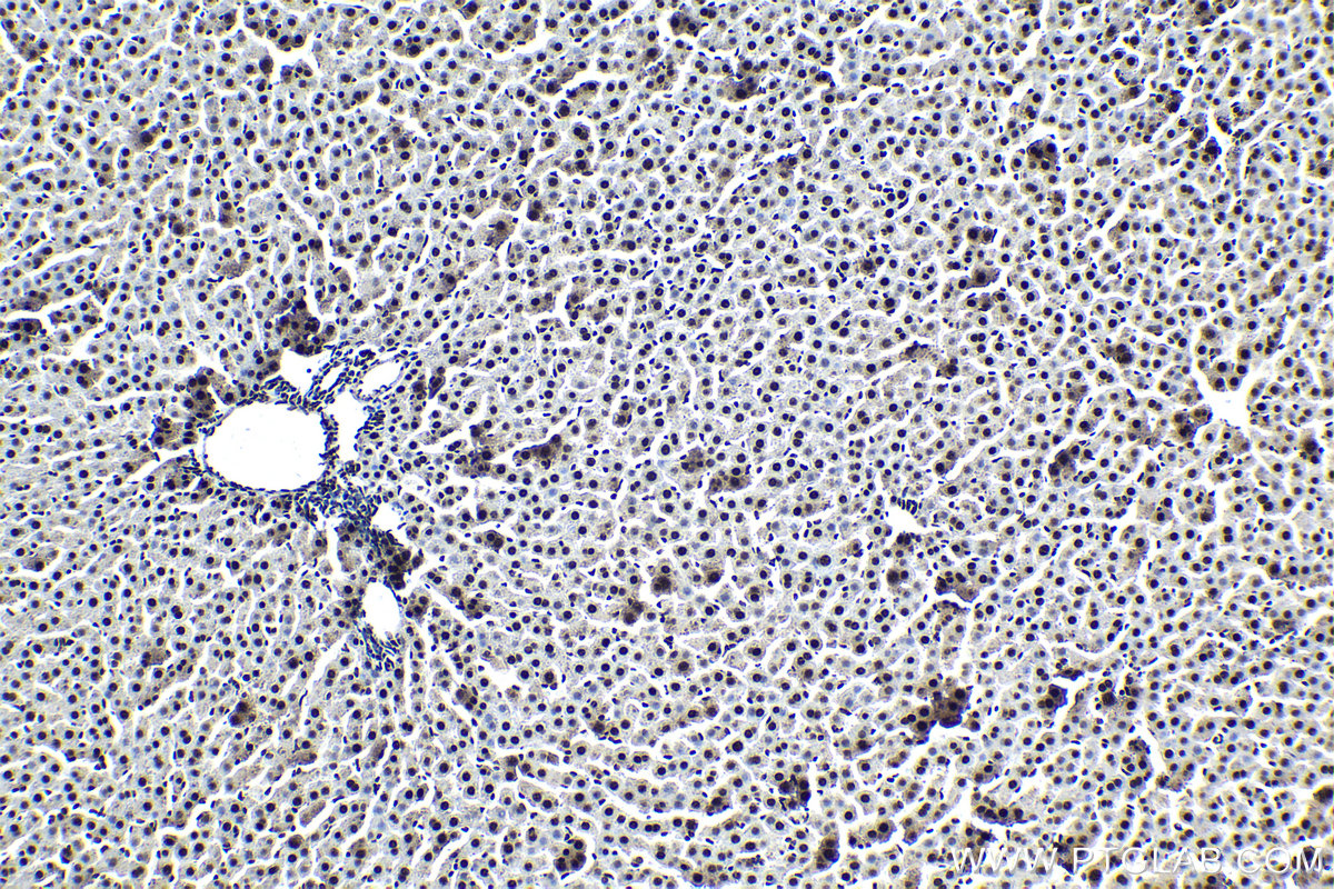 Immunohistochemical analysis of paraffin-embedded rat liver tissue slide using KHC1376 (BCLAF1 IHC Kit).