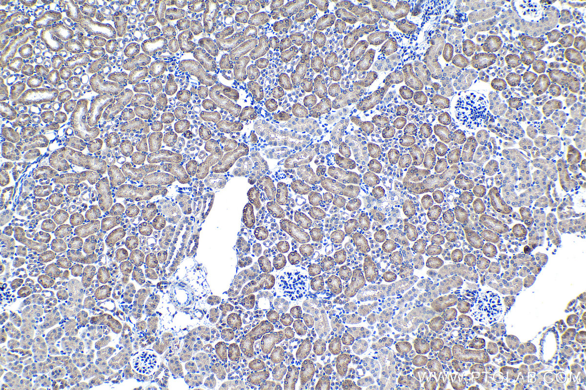 Immunohistochemical analysis of paraffin-embedded mouse kidney tissue slide using KHC1356 (BDH1 IHC Kit).