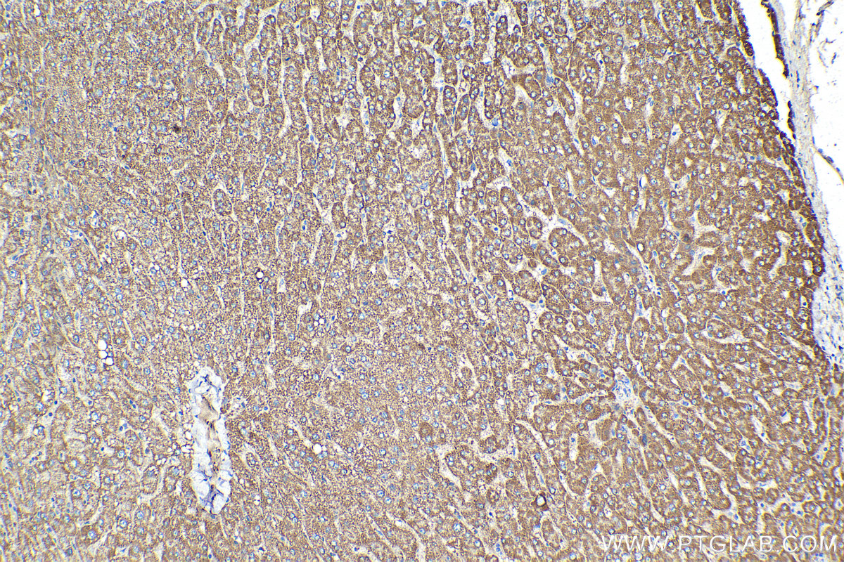 Immunohistochemical analysis of paraffin-embedded human liver tissue slide using KHC1356 (BDH1 IHC Kit).