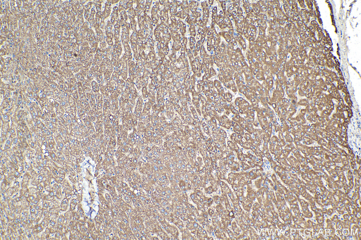 Immunohistochemical analysis of paraffin-embedded human liver tissue slide using KHC1356 (BDH1 IHC Kit).