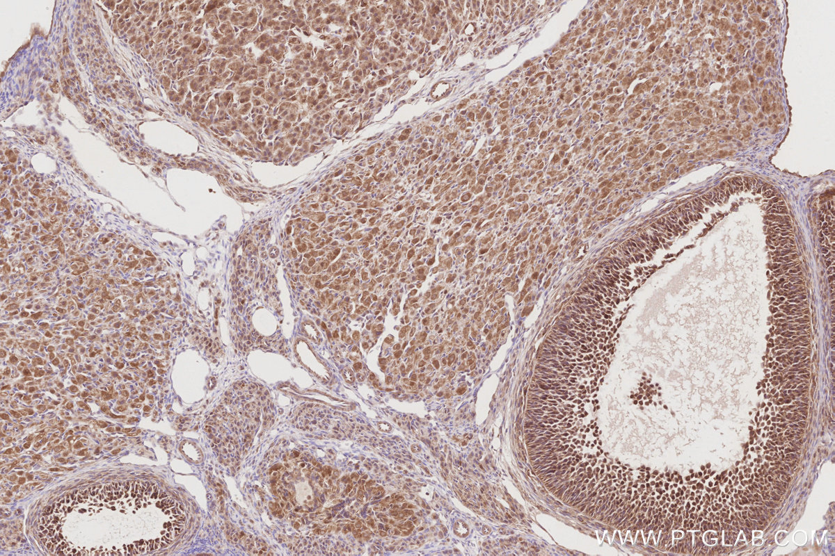 Immunohistochemical analysis of paraffin-embedded rat ovary tissue slide using KHC2884 (BEX1/2 IHC Kit). Immunohistochemical analysis of paraffin-embedded rat ovary tissue slide using KHC2884 (BEX1/2 IHC Kit).