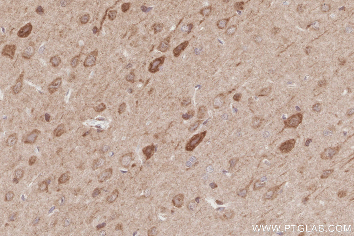 Immunohistochemical analysis of paraffin-embedded rat brain tissue slide using KHC2884 (BEX1/2 IHC Kit). Immunohistochemical analysis of paraffin-embedded rat brain tissue slide using KHC2884 (BEX1/2 IHC Kit).