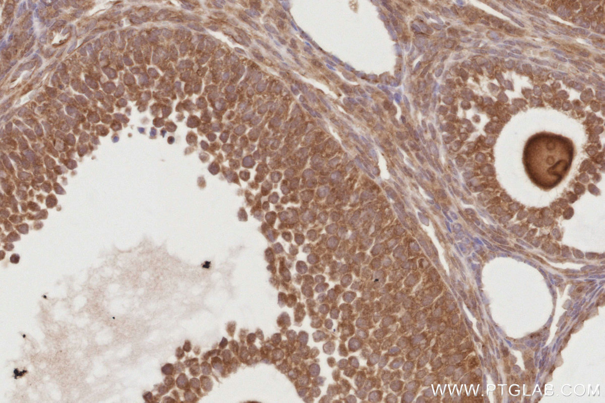 Immunohistochemical analysis of paraffin-embedded mouse ovary tissue slide using KHC2884 (BEX1/2 IHC Kit). Immunohistochemical analysis of paraffin-embedded mouse ovary tissue slide using KHC2884 (BEX1/2 IHC Kit).