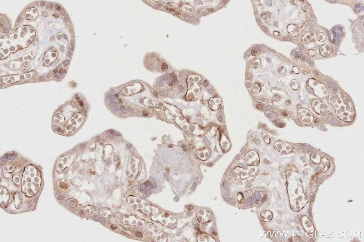 Immunohistochemical analysis of paraffin-embedded human placenta tissue slide using KHC2884 (BEX1/2 IHC Kit). Immunohistochemical analysis of paraffin-embedded human placenta tissue slide using KHC2884 (BEX1/2 IHC Kit).