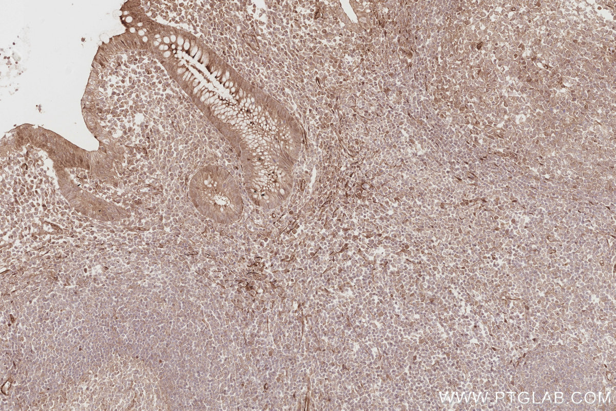 Immunohistochemical analysis of paraffin-embedded human appendicitis tissue slide using KHC2884 (BEX1/2 IHC Kit). Immunohistochemical analysis of paraffin-embedded human appendicitis tissue slide using KHC2884 (BEX1/2 IHC Kit).