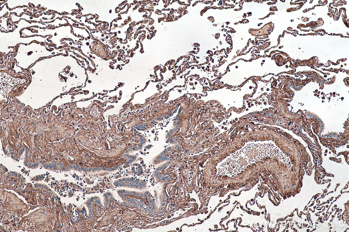 Immunohistochemical analysis of paraffin-embedded human lung tissue slide using KHC0480 (BGN/Biglycan IHC Kit).