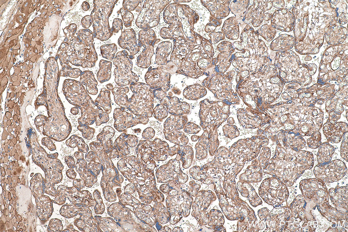 Immunohistochemical analysis of paraffin-embedded human placenta tissue slide using KHC0480 (BGN/Biglycan IHC Kit).