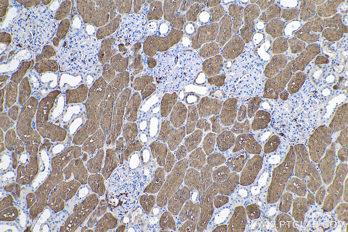 Immunohistochemical analysis of paraffin-embedded human kidney tissue slide using KHC0515 (BHMT IHC Kit).