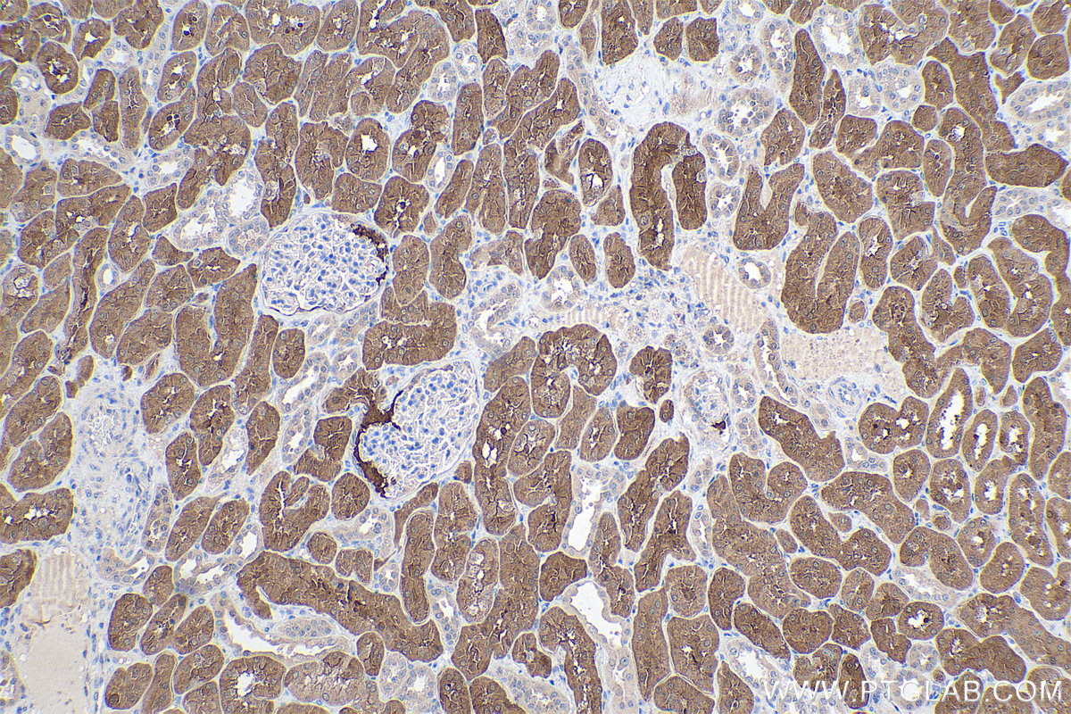 Immunohistochemical analysis of paraffin-embedded human kidney tissue slide using KHC0402 (BHMT2 IHC Kit).