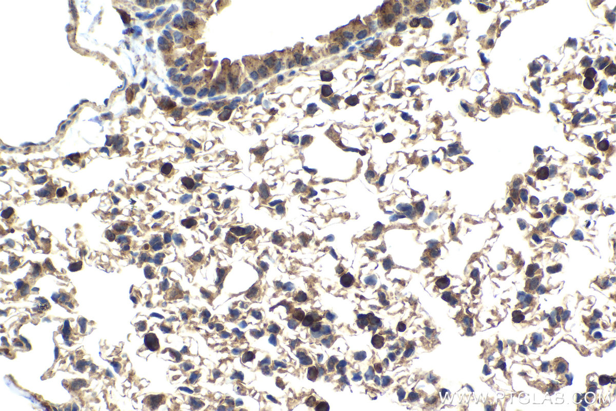 Immunohistochemical analysis of paraffin-embedded mouse lung tissue slide using KHC2048 (BIN1 IHC Kit).