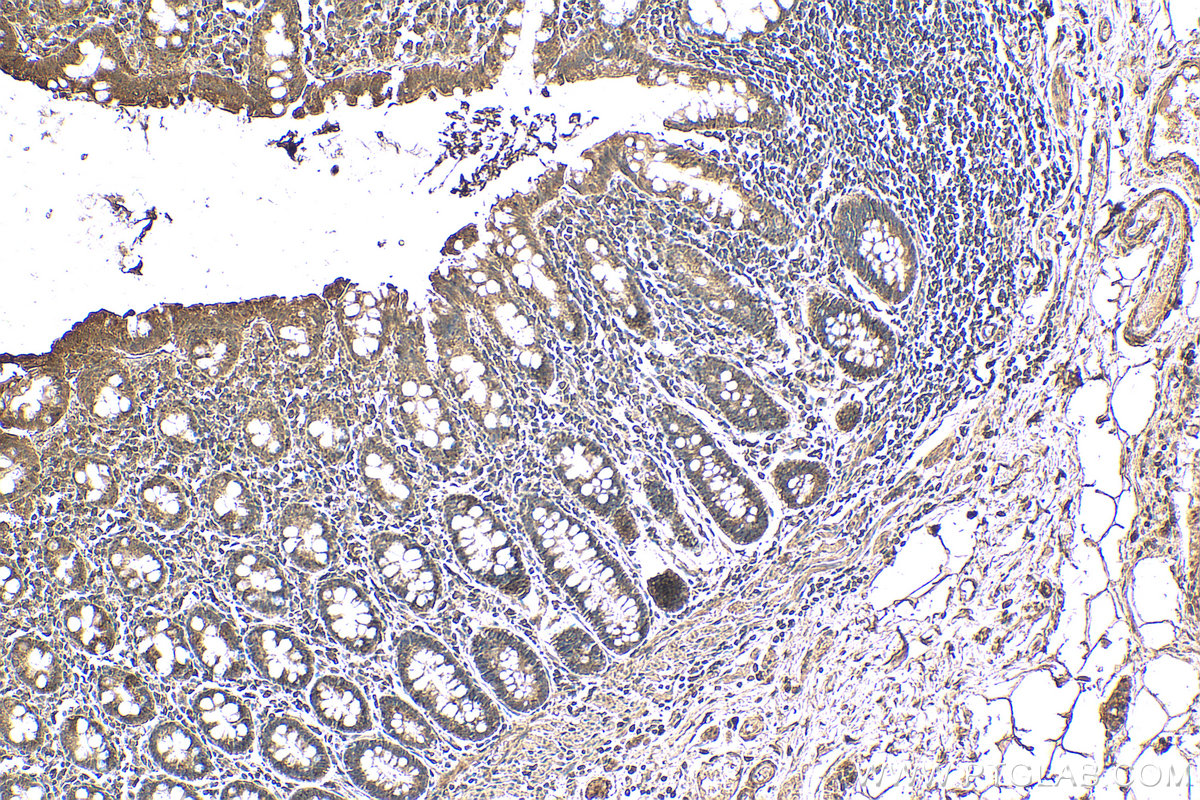 Immunohistochemical analysis of paraffin-embedded human colon tissue slide using KHC0620 (cIAP1 IHC Kit).