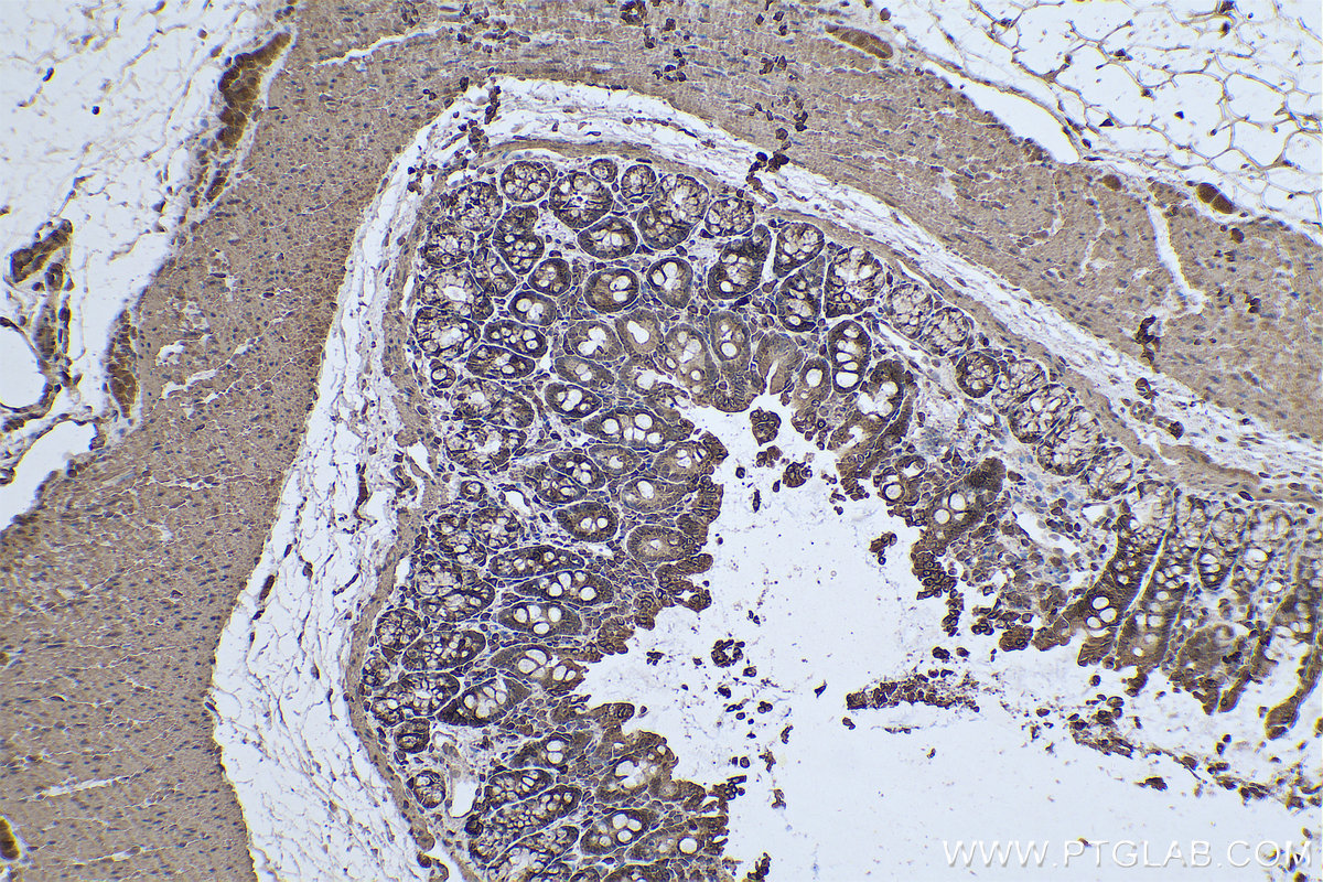 Immunohistochemical analysis of paraffin-embedded rat colon tissue slide using KHC0620 (cIAP1 IHC Kit).