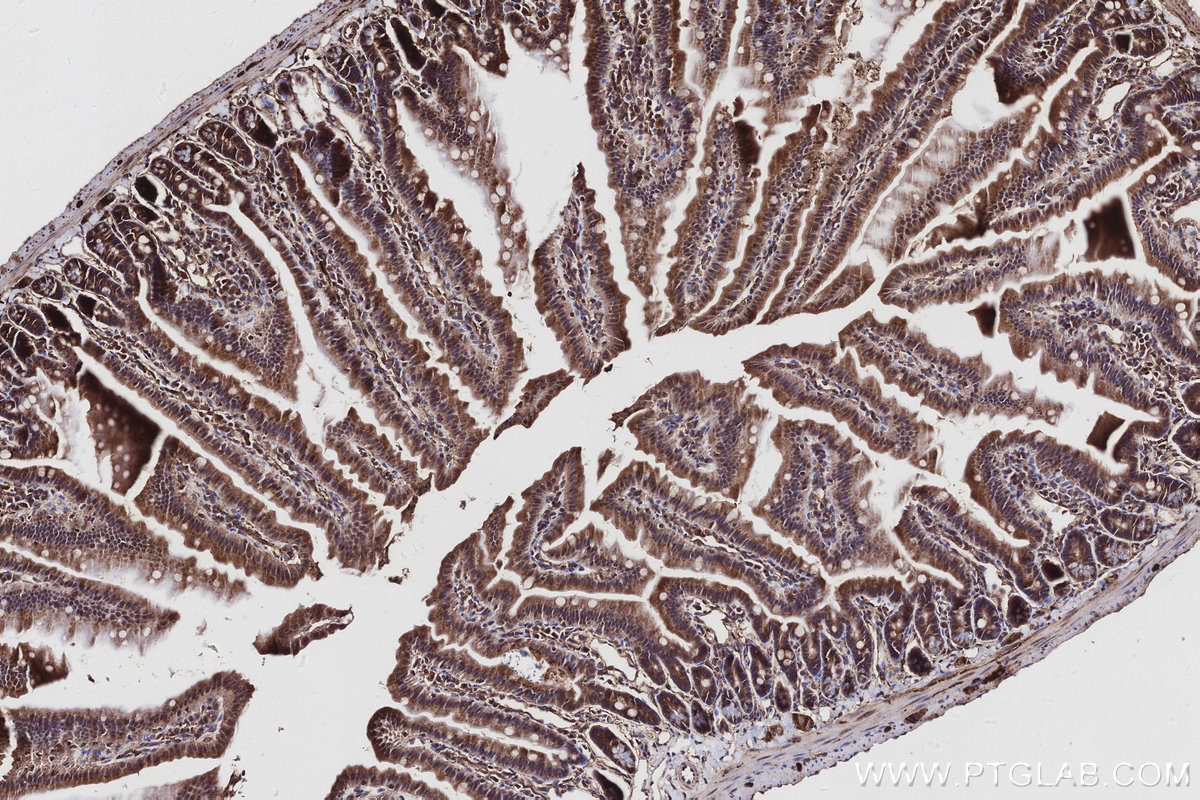 Immunohistochemical analysis of paraffin-embedded mouse small intestine tissue slide using KHC2946 (BIRC6 IHC Kit).