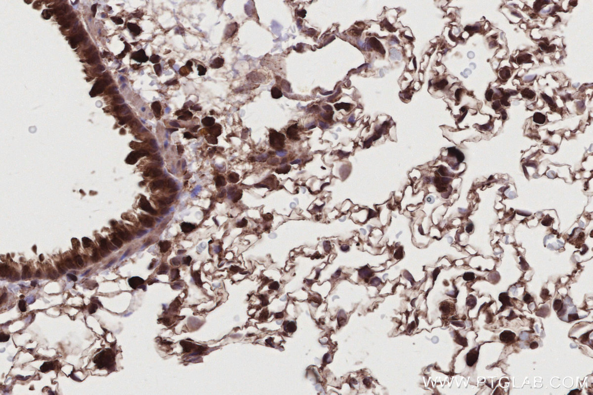 Immunohistochemical analysis of paraffin-embedded rat lung tissue slide using KHC2781 (BIRC7 IHC Kit).