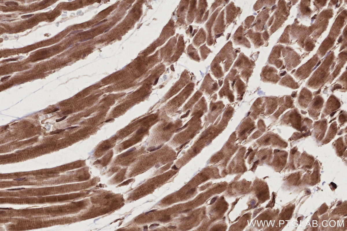 Immunohistochemical analysis of paraffin-embedded rat heart tissue slide using KHC2781 (BIRC7 IHC Kit).