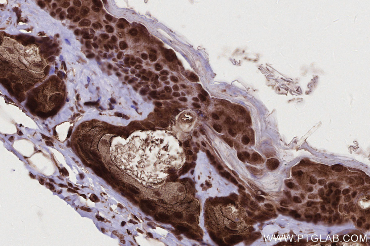 Immunohistochemical analysis of paraffin-embedded mouse skin tissue slide using KHC2781 (BIRC7 IHC Kit).