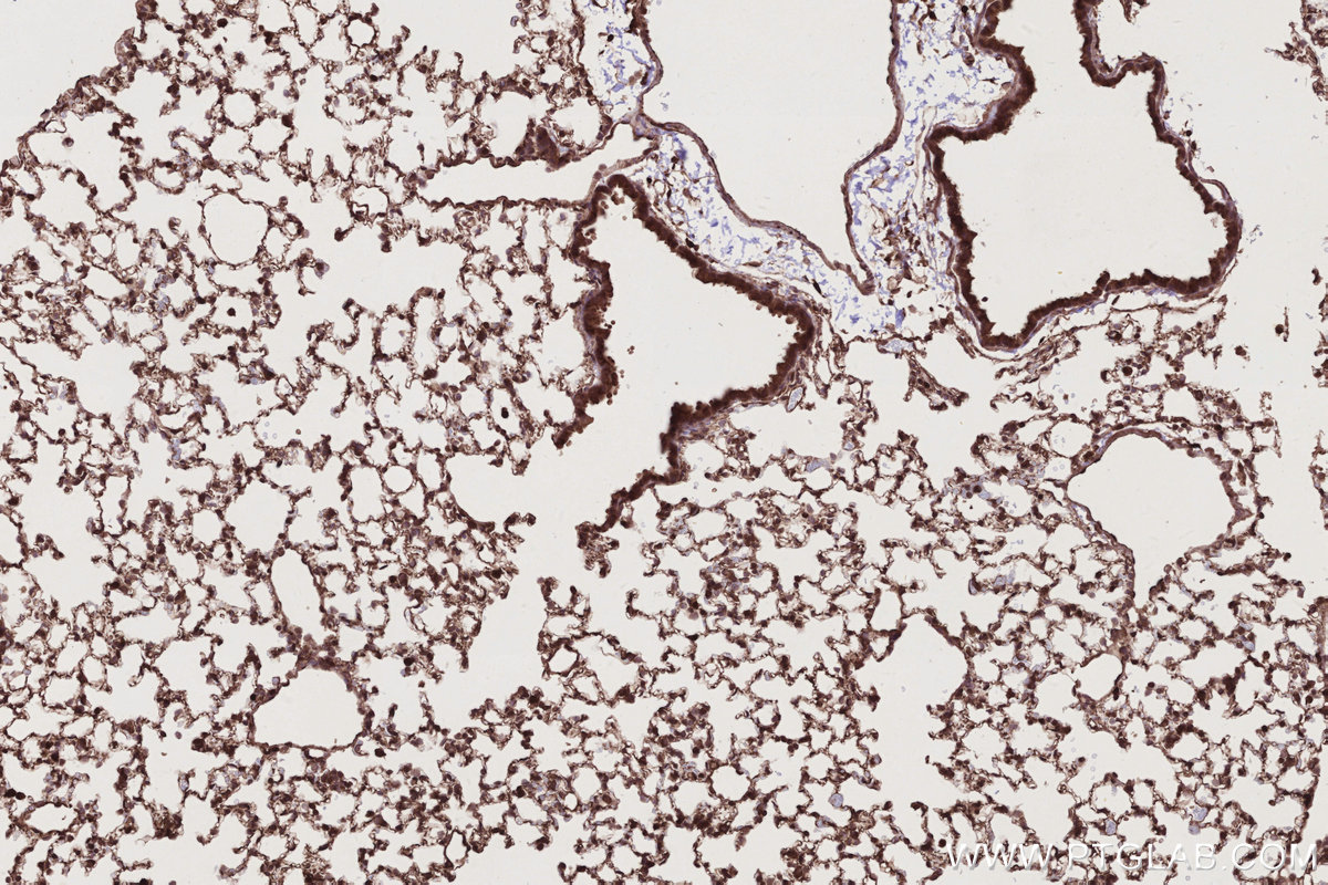 Immunohistochemical analysis of paraffin-embedded mouse lung tissue slide using KHC2781 (BIRC7 IHC Kit).