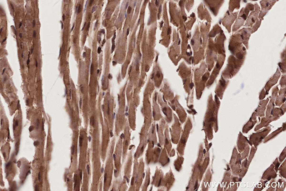 Immunohistochemical analysis of paraffin-embedded mouse heart tissue slide using KHC2781 (BIRC7 IHC Kit).