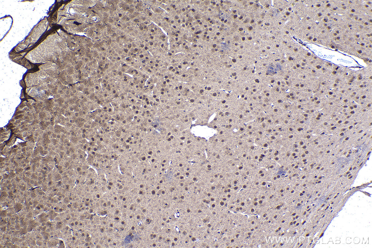 Immunohistochemical analysis of paraffin-embedded mouse brain tissue slide using KHC1421 (BMAL1/ARNTL IHC Kit).