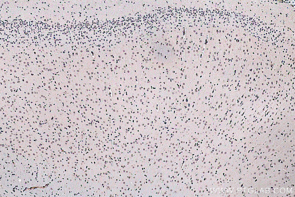 Immunohistochemical analysis of paraffin-embedded rat brain tissue slide using KHC0296 (BMI1 IHC Kit).