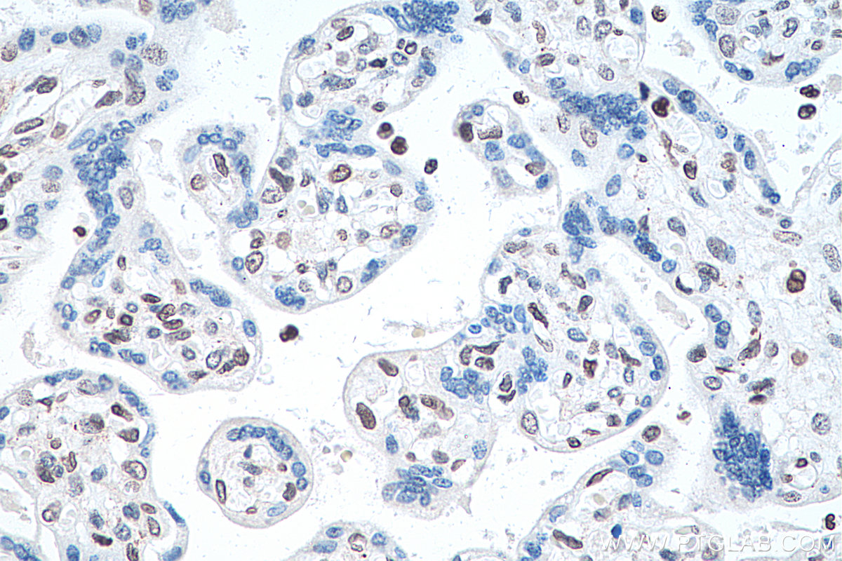 Immunohistochemical analysis of paraffin-embedded human placenta tissue slide using KHC0296 (BMI1 IHC Kit).