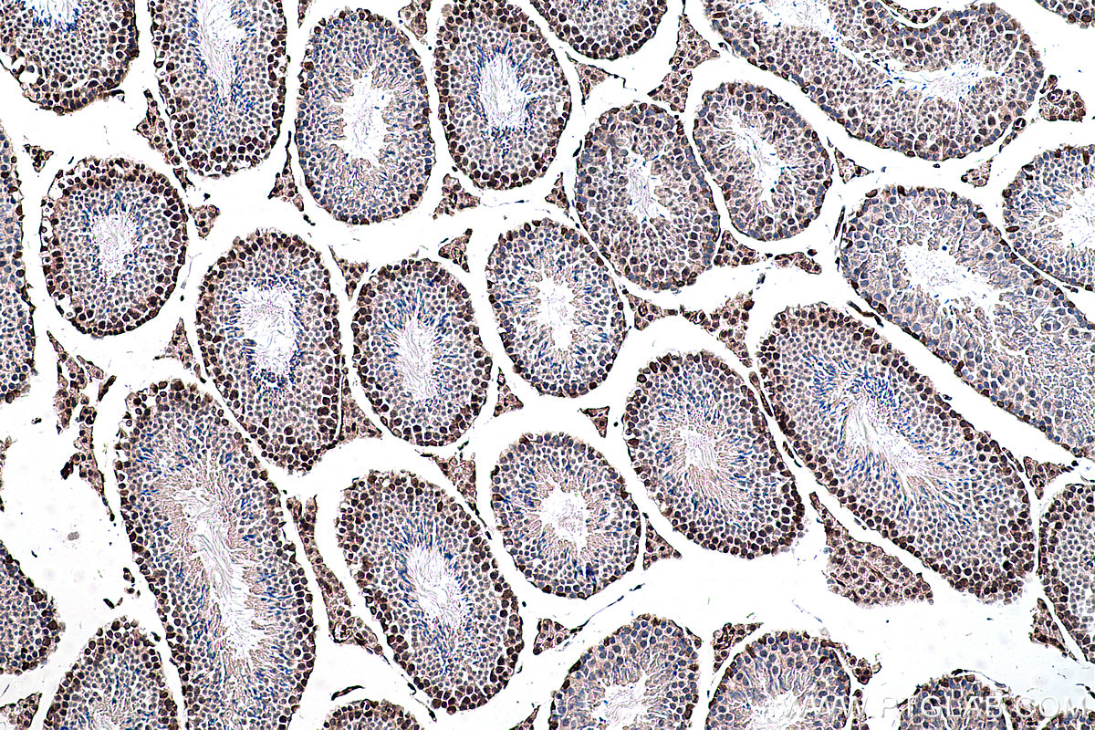 Immunohistochemical analysis of paraffin-embedded mouse testis tissue slide using KHC0296 (BMI1 IHC Kit).