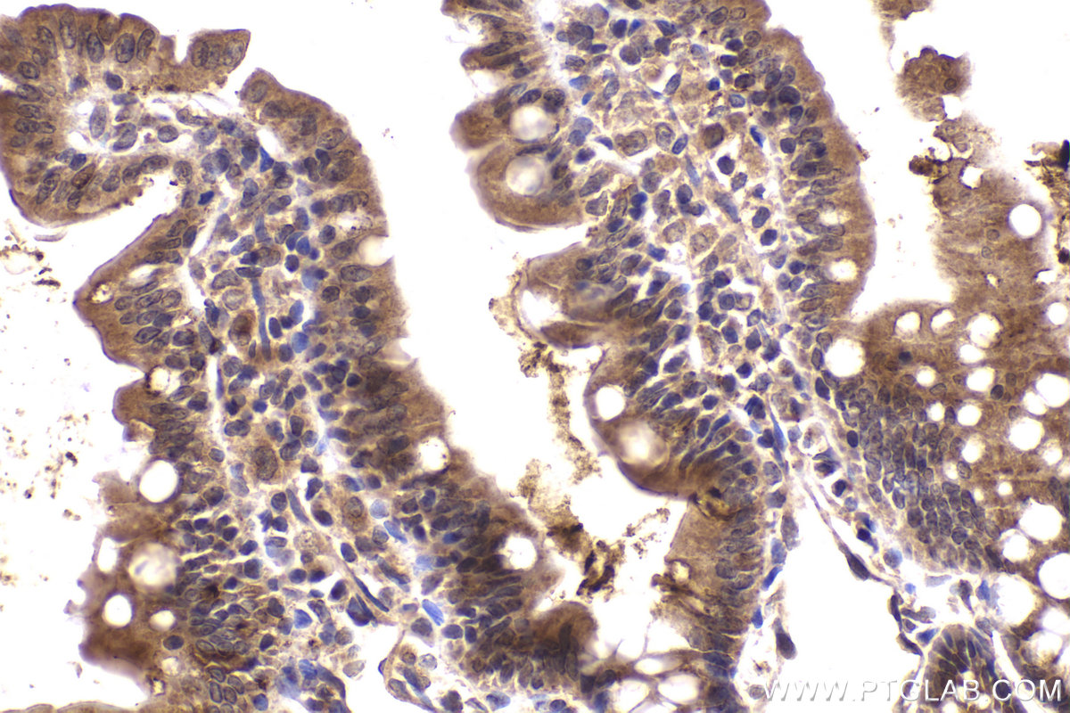 Immunohistochemical analysis of paraffin-embedded rat small intestine tissue slide using KHC2183 (BMP4 IHC Kit).