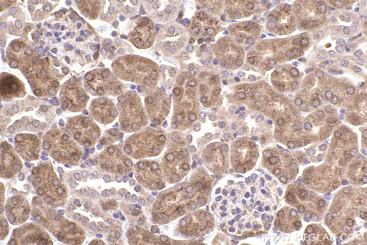 Immunohistochemical analysis of paraffin-embedded mouse kidney tissue slide using KHC2413 (BNIP2 IHC Kit).