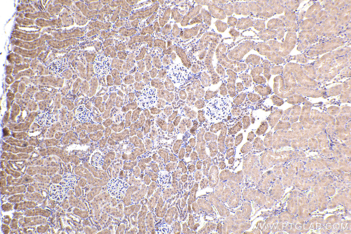Immunohistochemical analysis of paraffin-embedded rat kidney tissue slide using KHC2413 (BNIP2 IHC Kit).