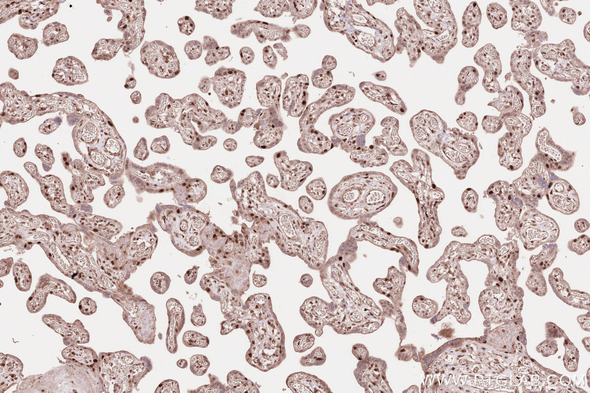 Immunohistochemical analysis of paraffin-embedded human placenta tissue slide using KHC2592 (BRAT1 IHC Kit).