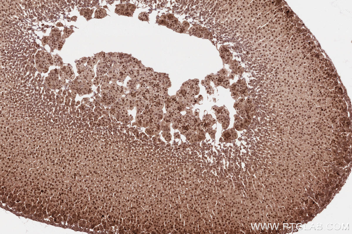 Immunohistochemical analysis of paraffin-embedded mouse adrenal gland tissue slide using KHC2592 (BRAT1 IHC Kit).