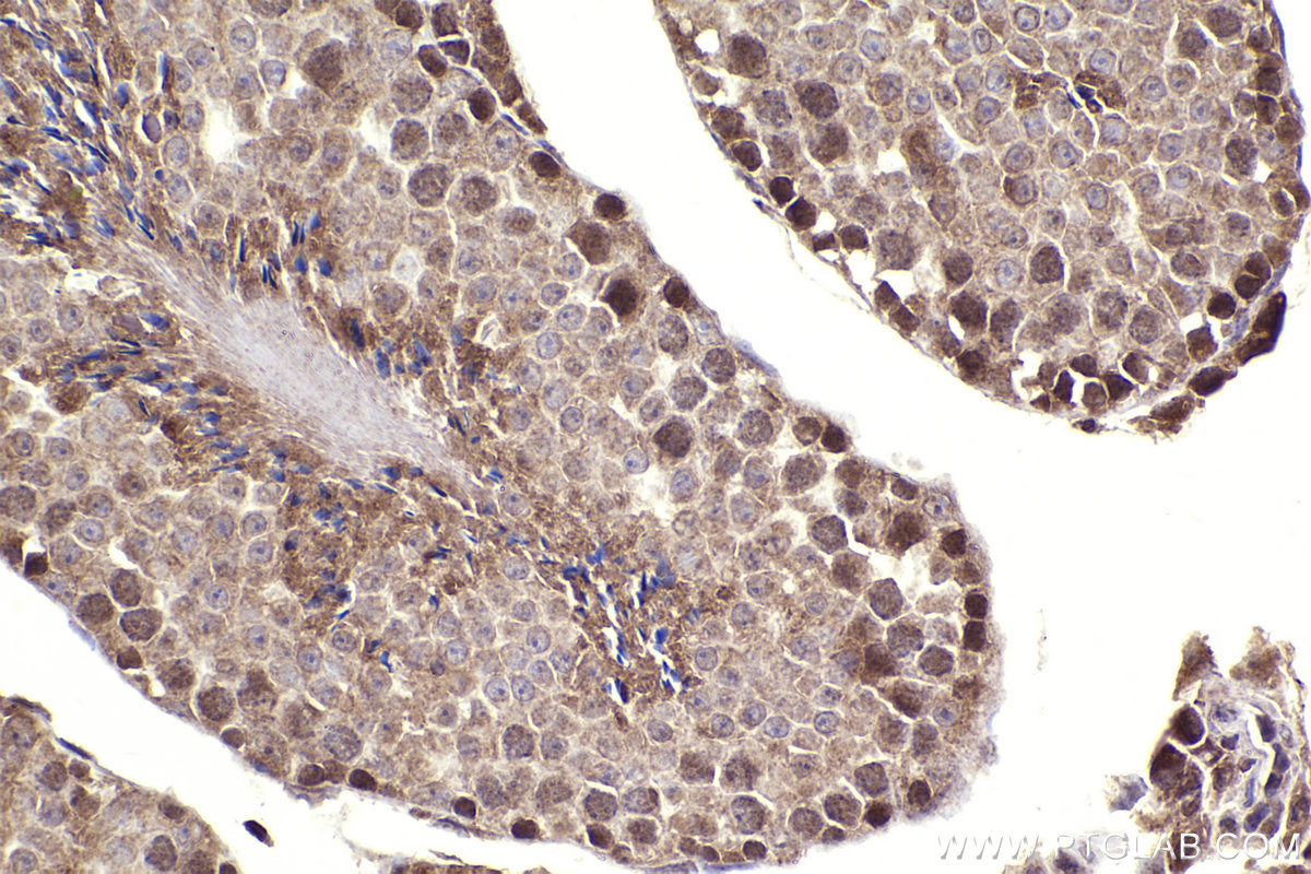 Immunohistochemical analysis of paraffin-embedded mouse testis tissue slide using KHC2278 (BRCC3 IHC Kit).