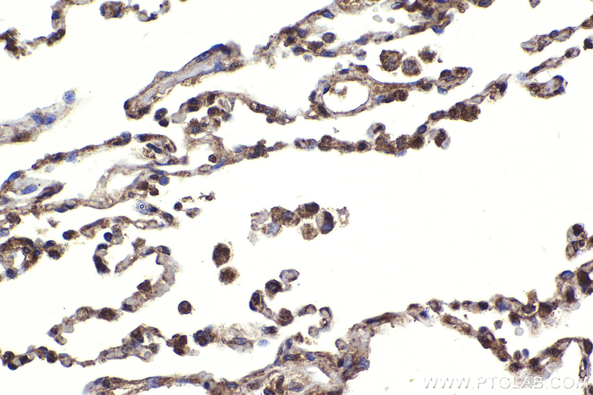 Immunohistochemical analysis of paraffin-embedded human lung tissue slide using KHC2278 (BRCC3 IHC Kit).