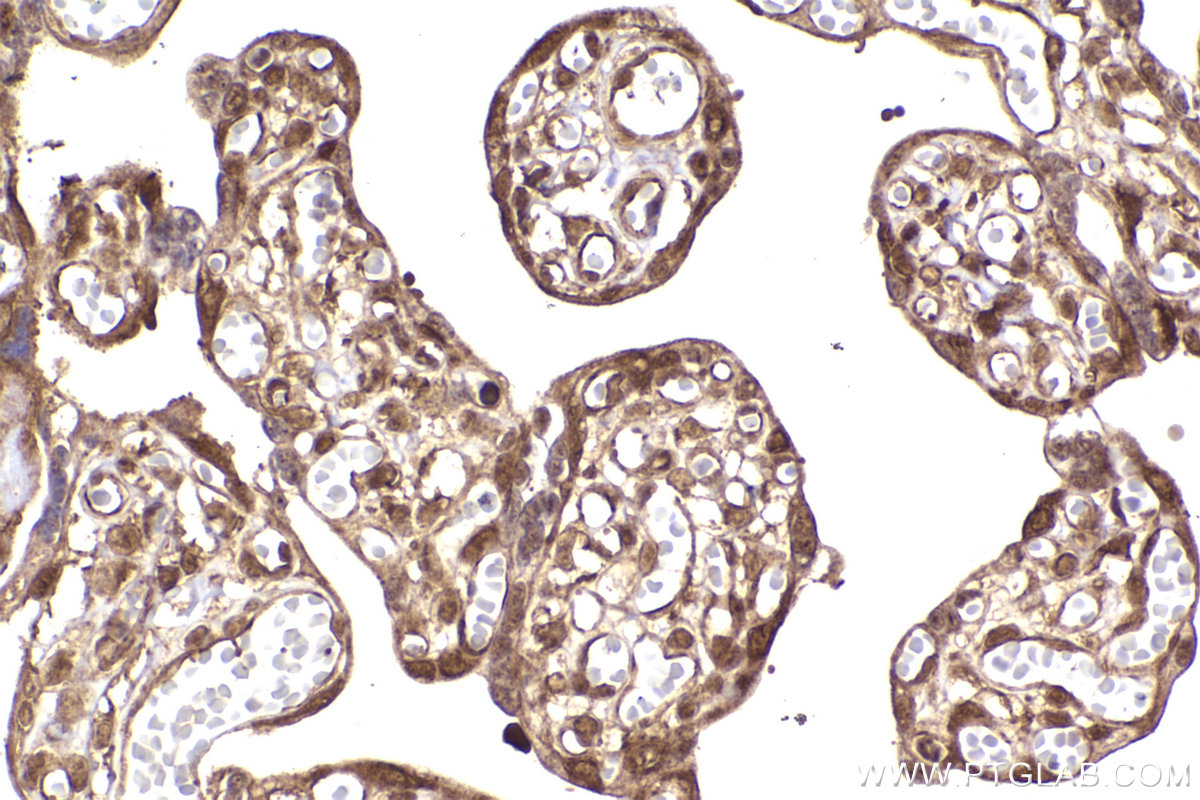 Immunohistochemical analysis of paraffin-embedded human placenta tissue slide using KHC2278 (BRCC3 IHC Kit).