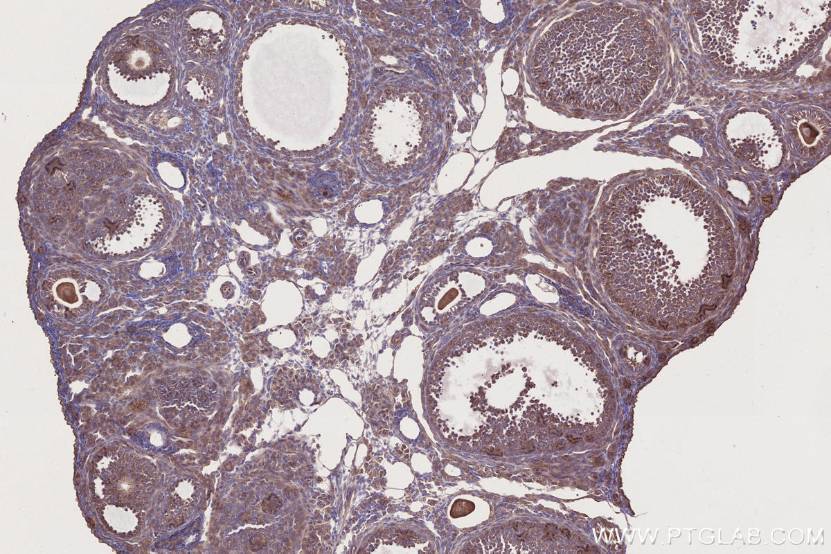Immunohistochemical analysis of paraffin-embedded mouse ovary tissue slide using KHC2733 (BRK1/C3orf10 IHC Kit).