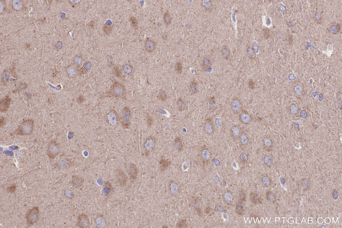 Immunohistochemical analysis of paraffin-embedded rat brain tissue slide using KHC2652 (BRSK2 IHC Kit).