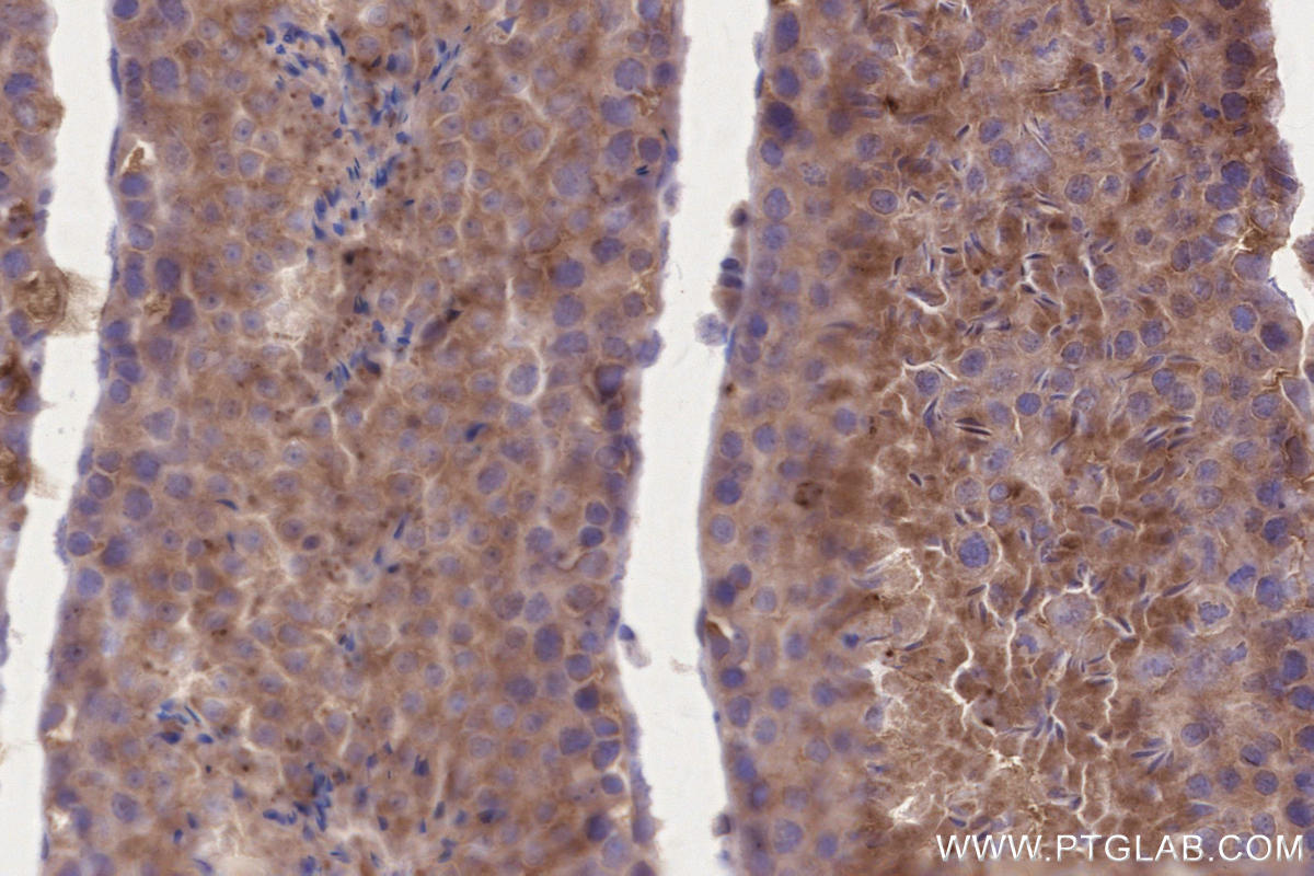 Immunohistochemical analysis of paraffin-embedded mouse testis tissue slide using KHC2652 (BRSK2 IHC Kit).