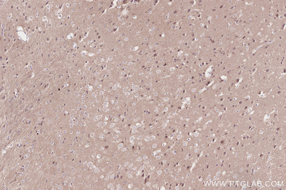 Immunohistochemical analysis of paraffin-embedded mouse brain tissue slide using KHC2652 (BRSK2 IHC Kit).