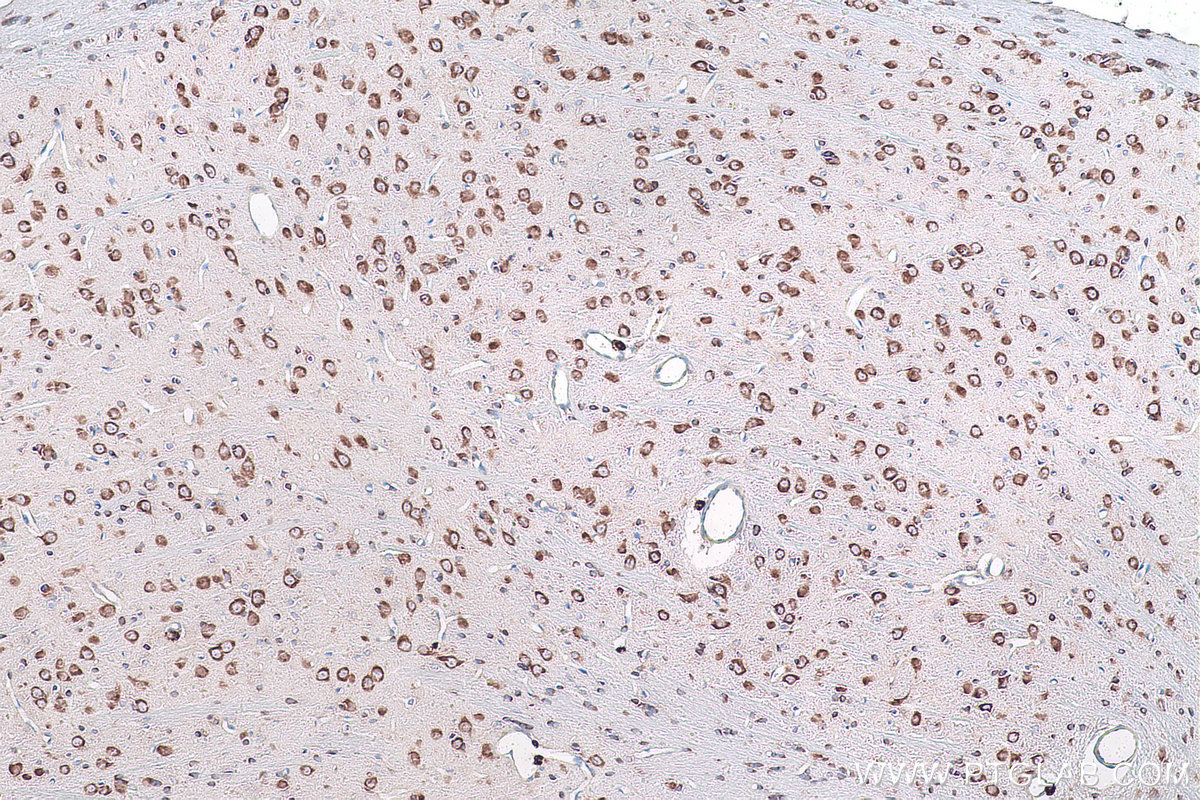 Immunohistochemical analysis of paraffin-embedded rat brain tissue slide using KHC1009 (BTF3L4 IHC Kit).