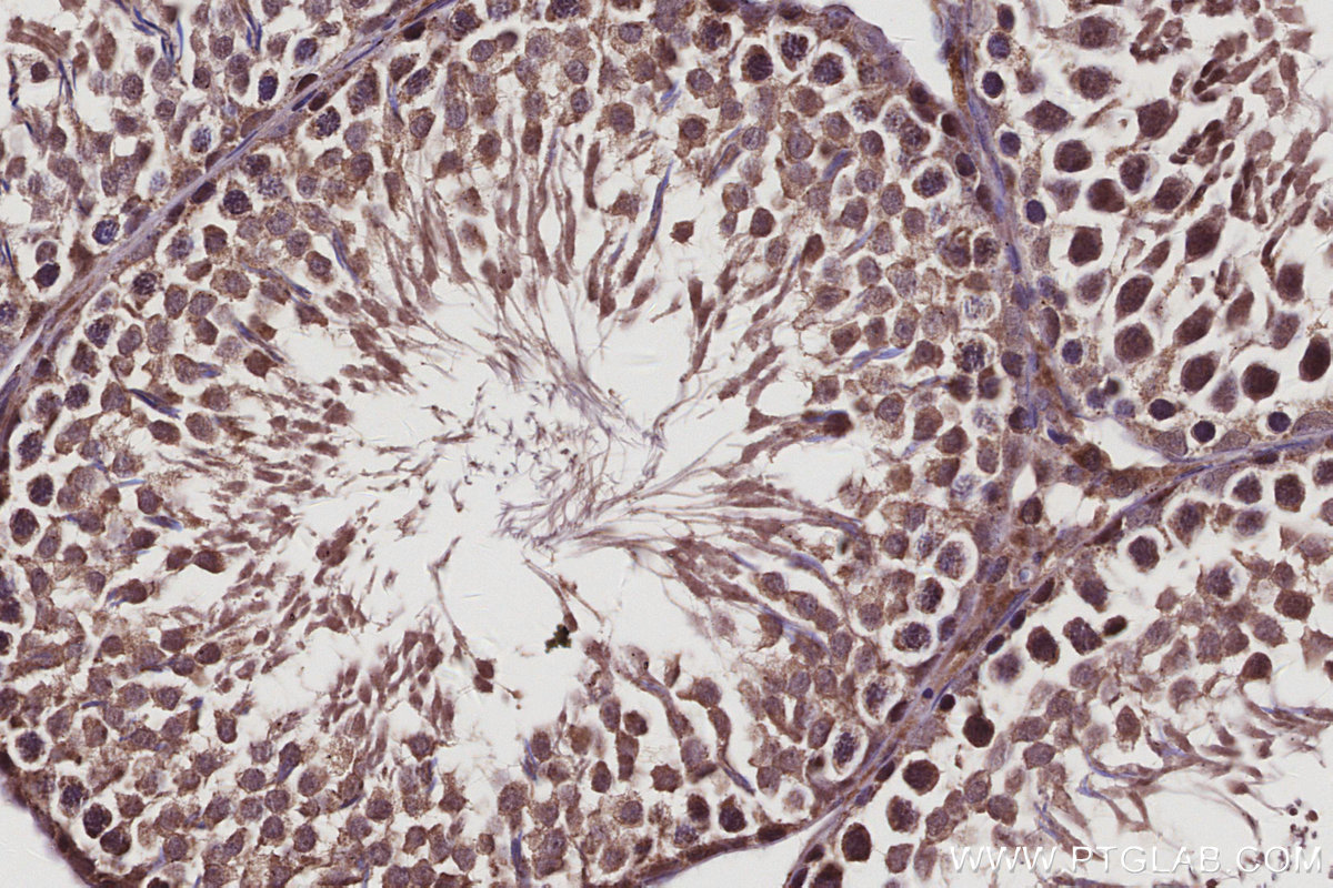 Immunohistochemical analysis of paraffin-embedded rat testis tissue slide using KHC2972 (BTG4 IHC Kit).