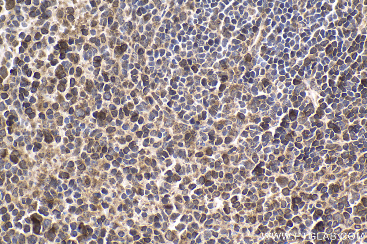 Immunohistochemical analysis of paraffin-embedded mouse spleen tissue slide using KHC1677 (BTK IHC Kit).