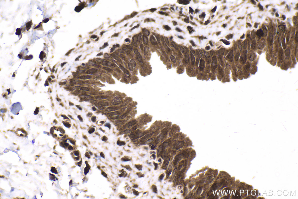 Immunohistochemical analysis of paraffin-embedded rat bladder tissue slide using KHC1677 (BTK IHC Kit).