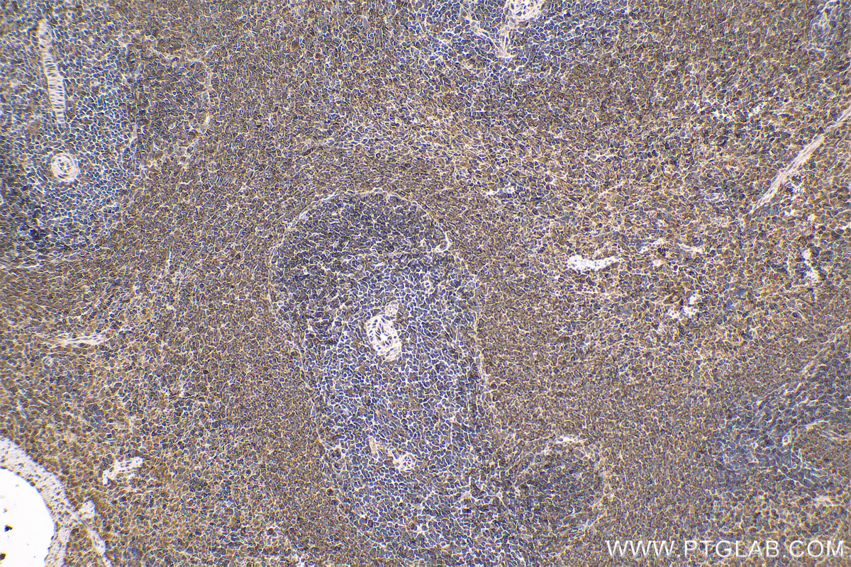 Immunohistochemical analysis of paraffin-embedded rat spleen tissue slide using KHC1677 (BTK IHC Kit).