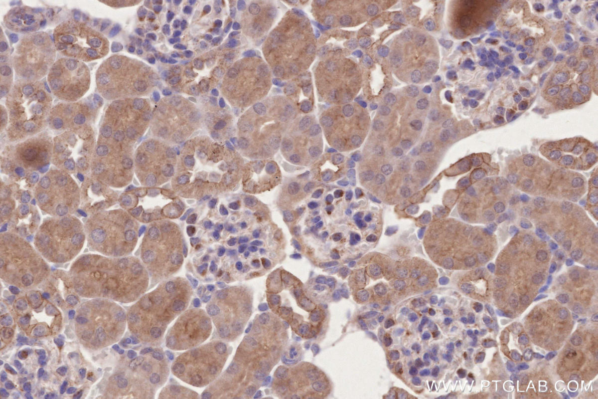 Immunohistochemical analysis of paraffin-embedded mouse kidney tissue slide using KHC2737 (BTN2A2 IHC Kit).