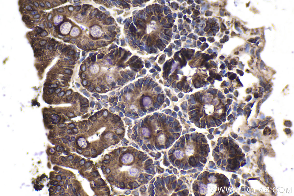 Immunohistochemical analysis of paraffin-embedded mouse intestine tissue slide using KHC2013 (BTRC IHC Kit).