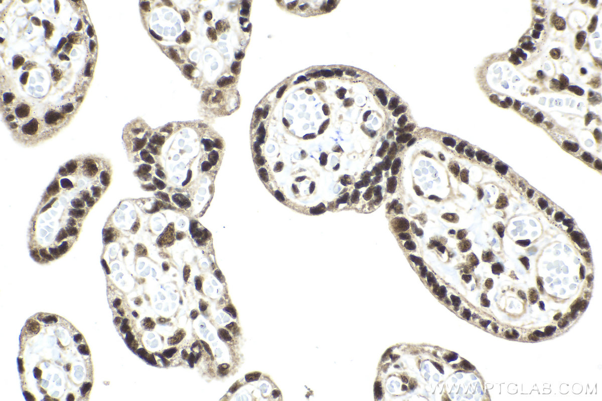 Immunohistochemical analysis of paraffin-embedded human placenta tissue slide using KHC2091 (BUB3 IHC Kit).
