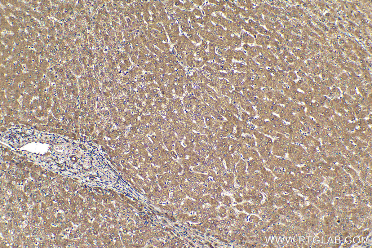 Immunohistochemical analysis of paraffin-embedded human liver tissue slide using KHC1358 (BYSL IHC Kit).